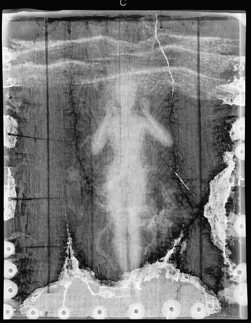 Radiographie